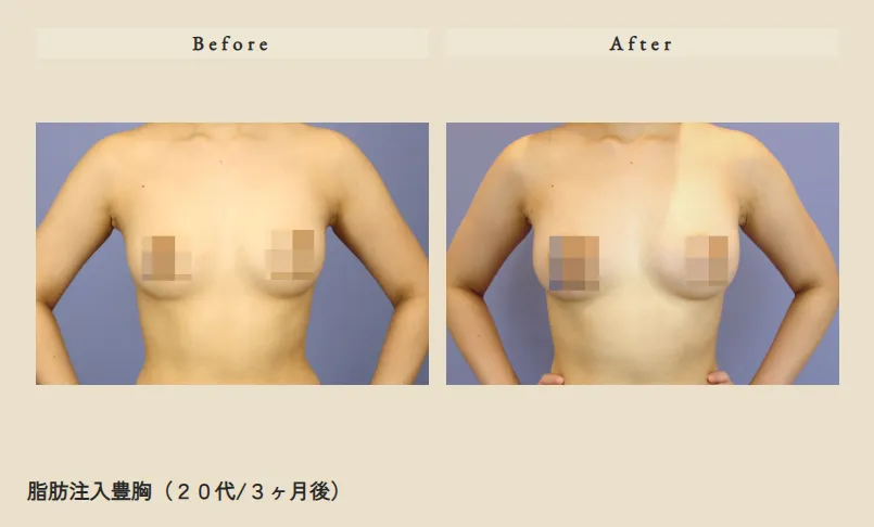 人中短縮症例