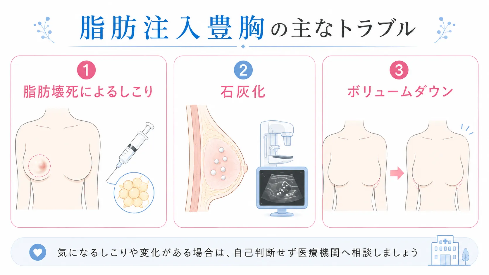 脂肪注入豊胸によるトラブル│脂肪壊死、石灰化、ボリュームダウンのイラスト画像