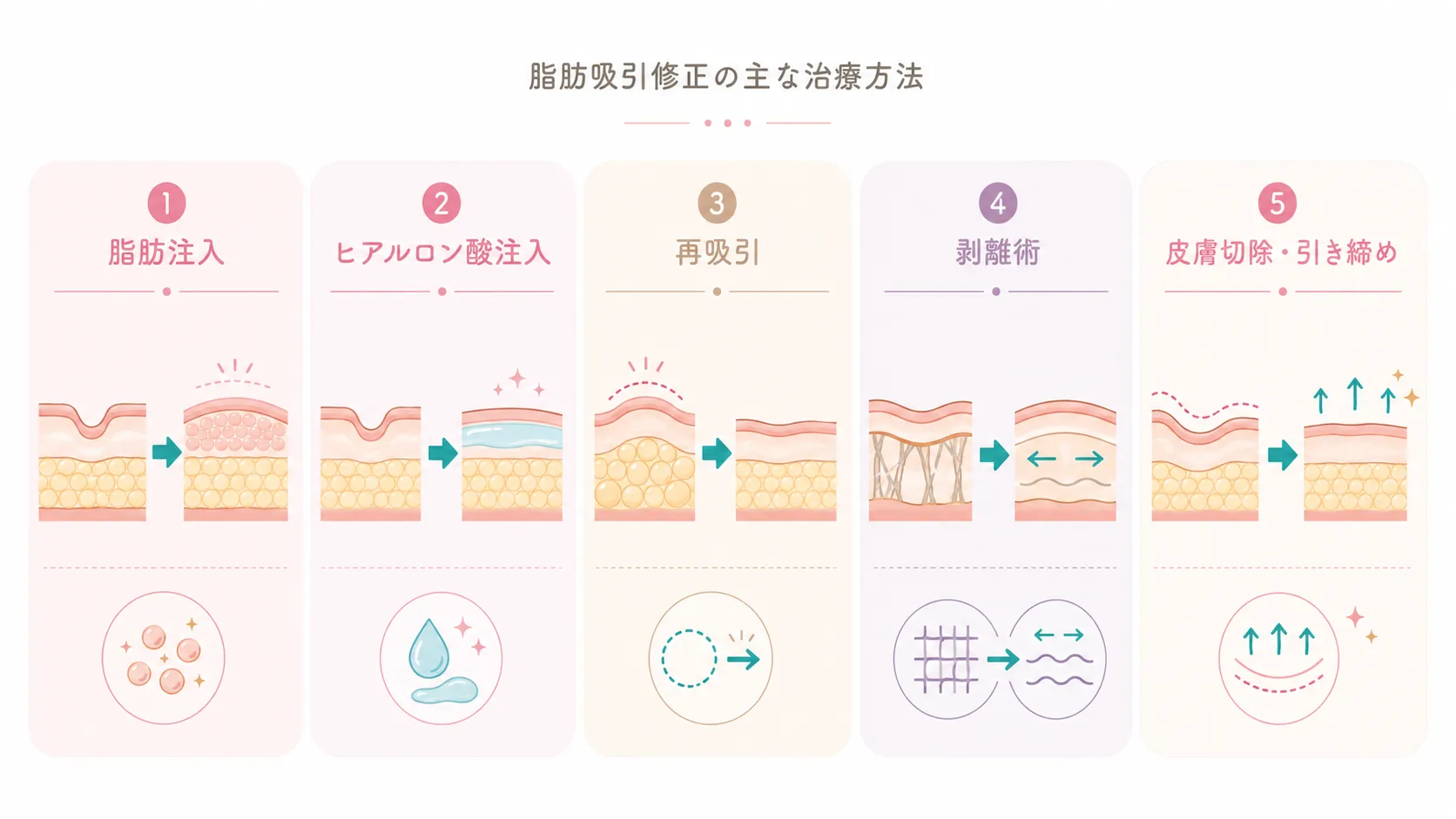 脂肪吸引修正の主な治療方法