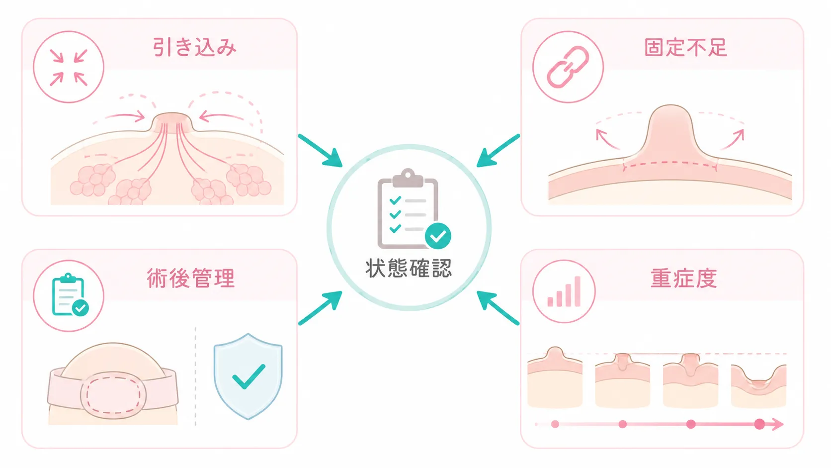 陥没乳頭手術後に再発する主な理由