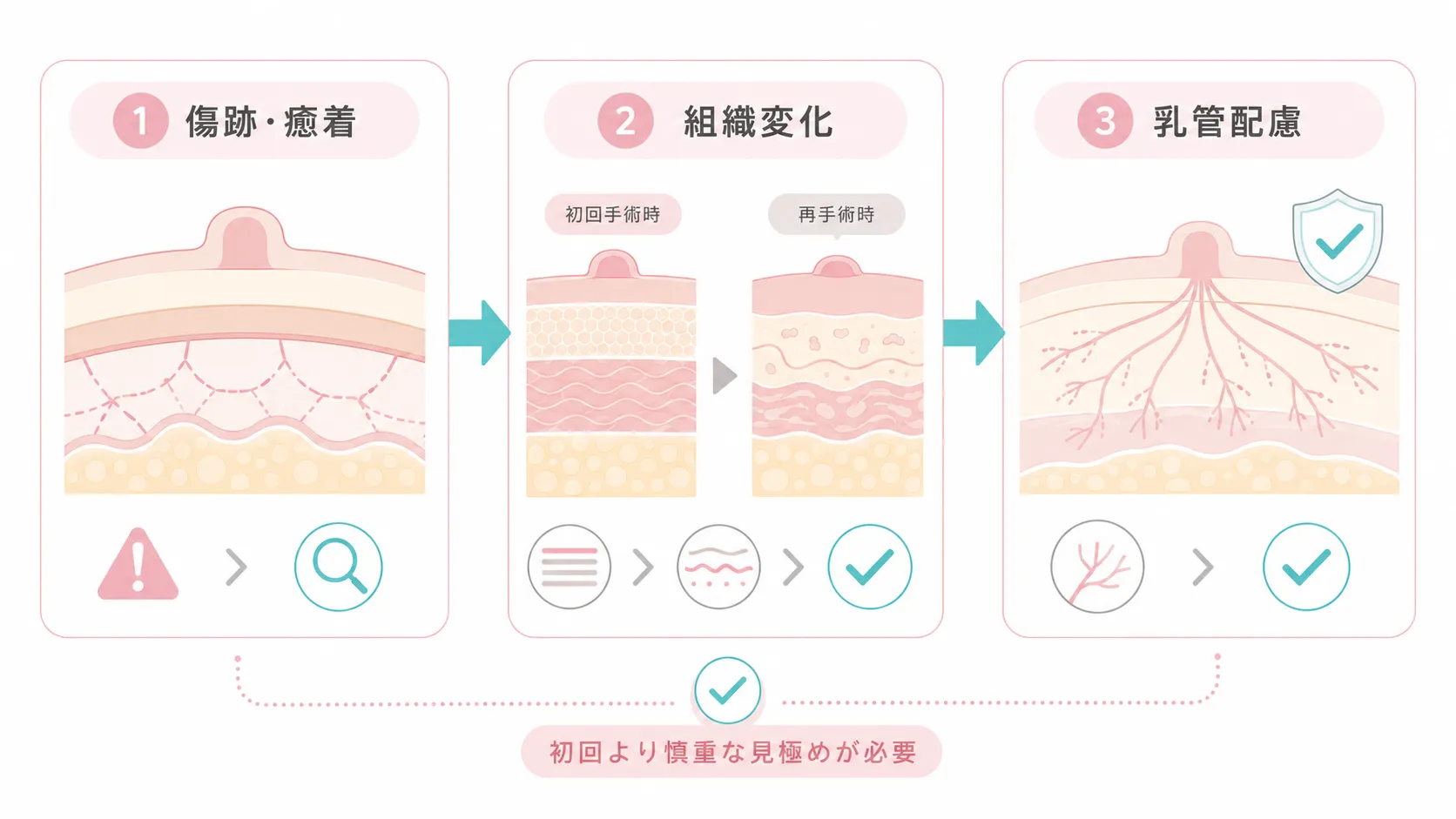 陥没乳頭の再手術が初回より難しくなりやすい理由