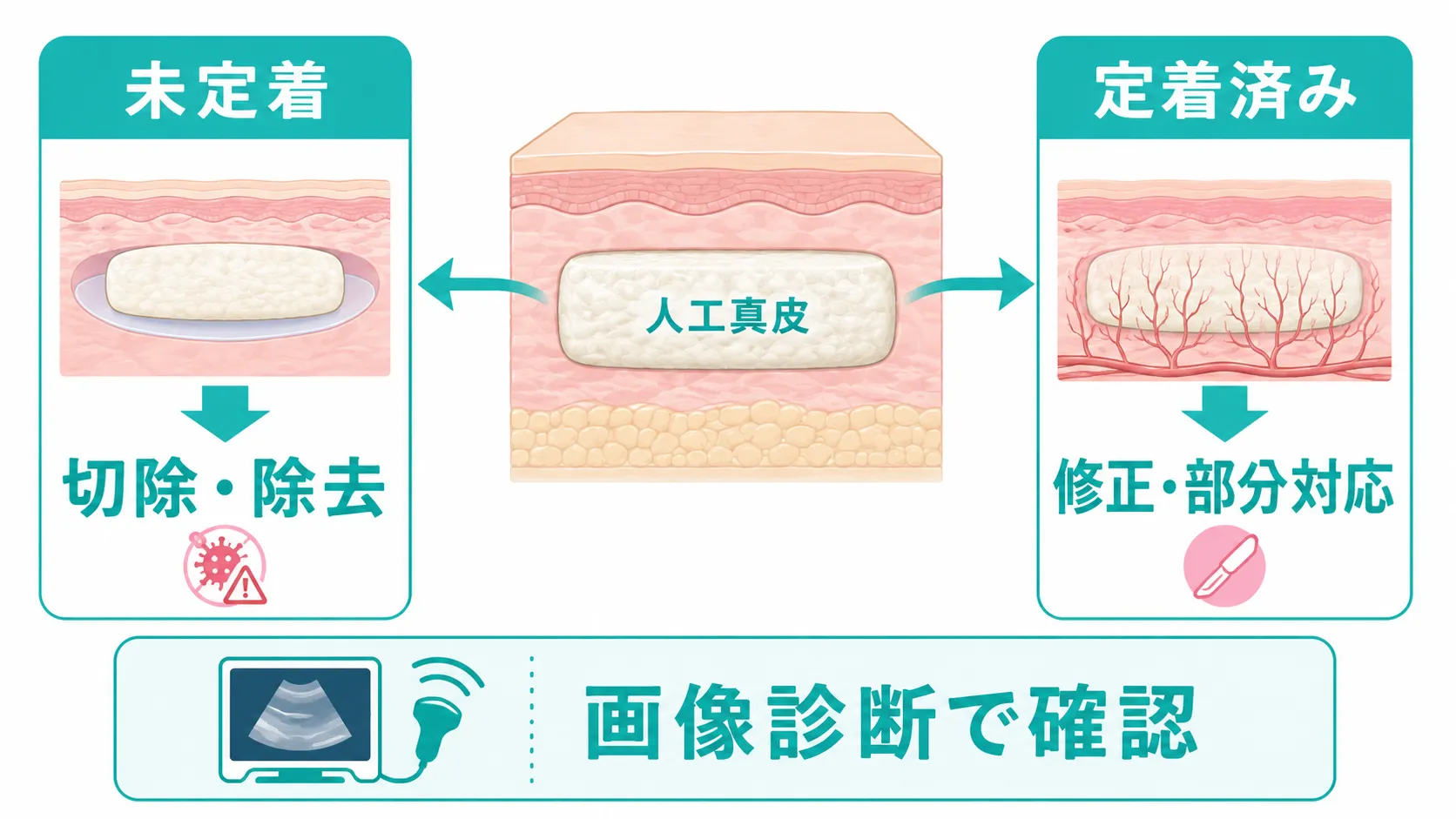 施術別の修正・除去方法│人工真皮のアイキャッチ画像